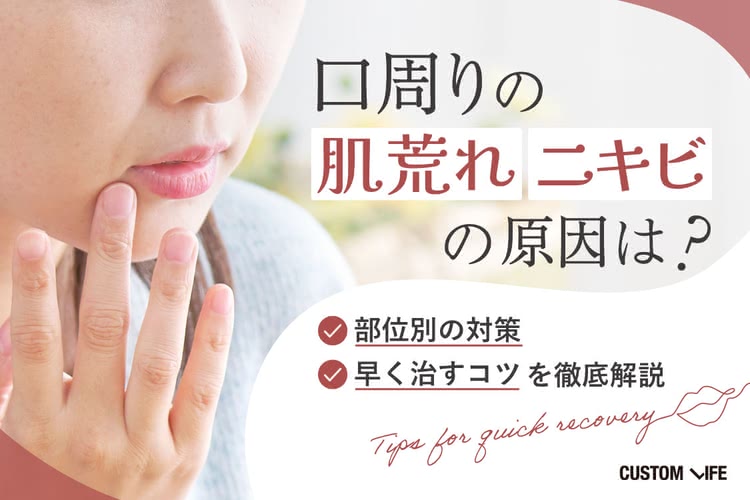口周りの肌荒れ・ニキビの原因は？部位別の対策や早く治すコツを徹底解説