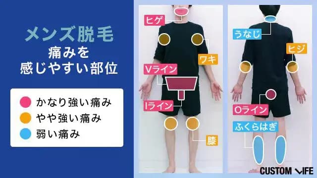痛みを感じやすい部位の図解