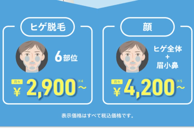 ヒゲ脱毛,体験,メンズクリア