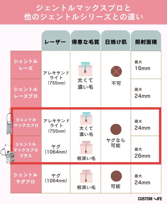 ジェントルマックスプロとジェントルシリーズの違い