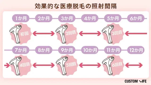医療脱毛の間隔