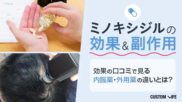 ミノキシジルの効果と副作用とは?【102名に調査】治療期間・外用薬と内服薬の違いを写真付きで解説