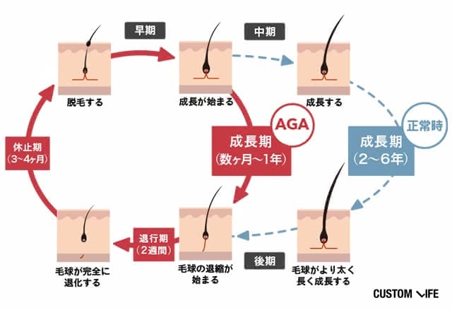 AHAの進行過程