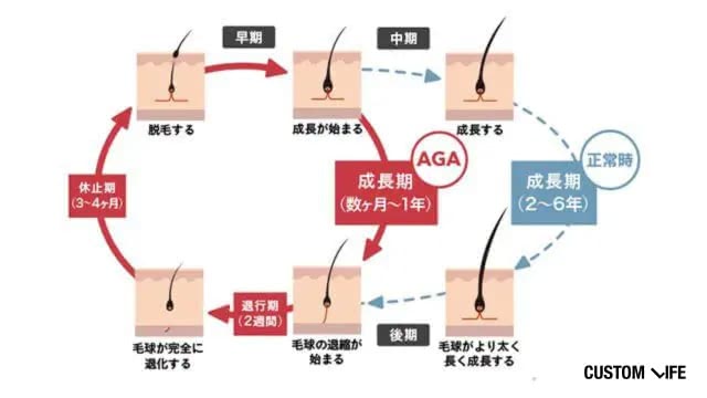 AGAを発症する仕組み