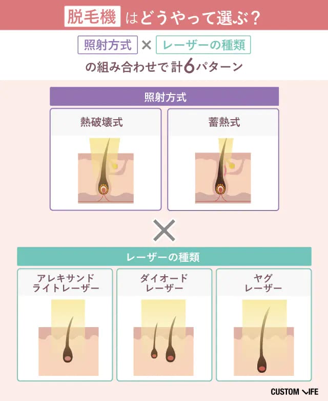 脱毛機の種類