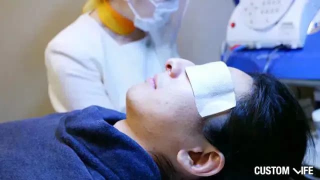 メンズTBCでヒゲ脱毛を受けようとしている編集部員