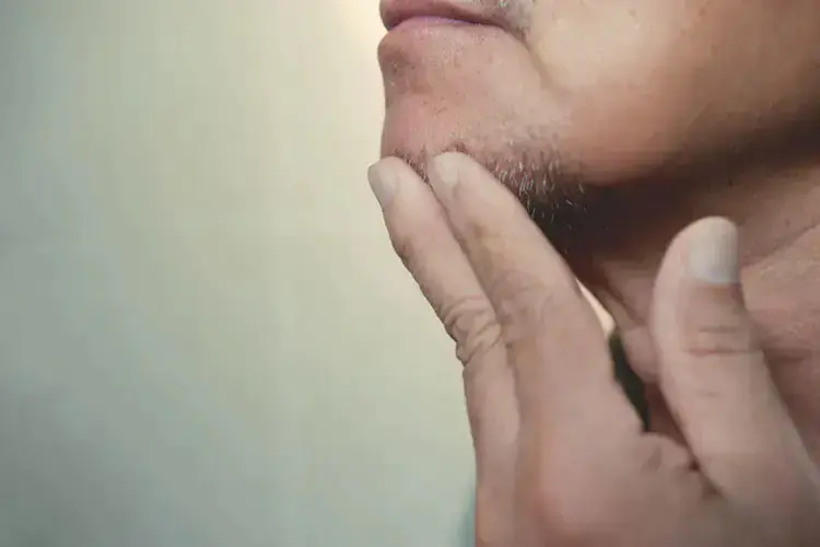 ヒゲ脱毛,効果