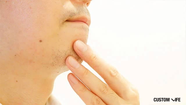 ヒゲ脱毛を考えている男性