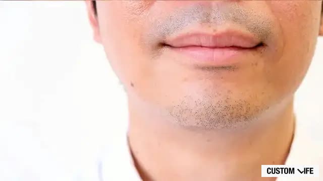 男性のヒゲ
