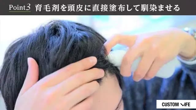 育毛剤を塗布する男性のイメージ