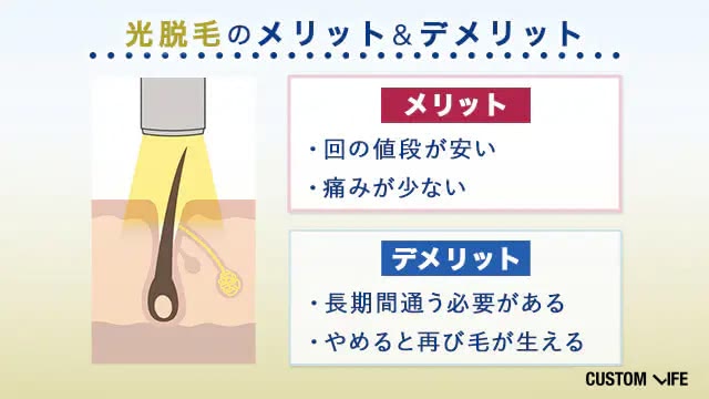 光脱毛のメリット・デメリット