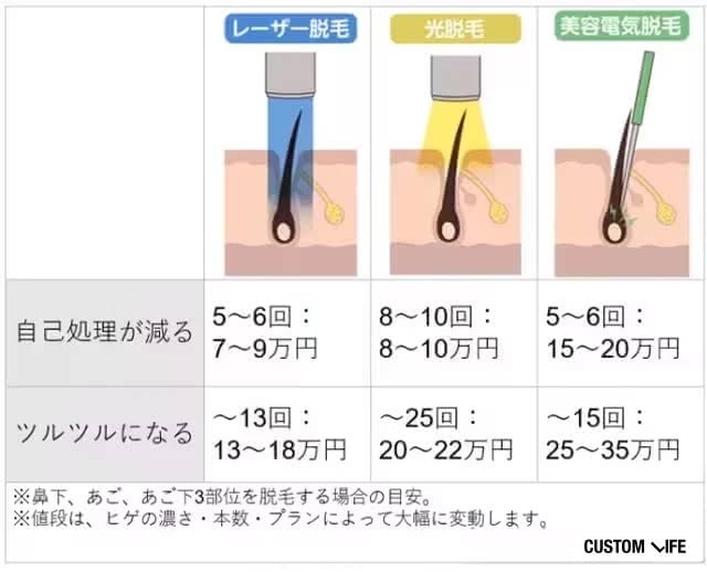 ヒゲ脱毛 値段