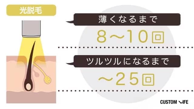 光脱毛のヒゲ脱毛効果