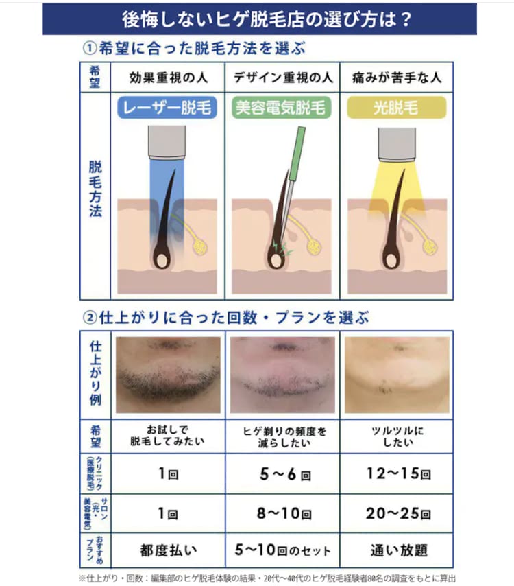 ヒゲ脱毛の選び方の画像