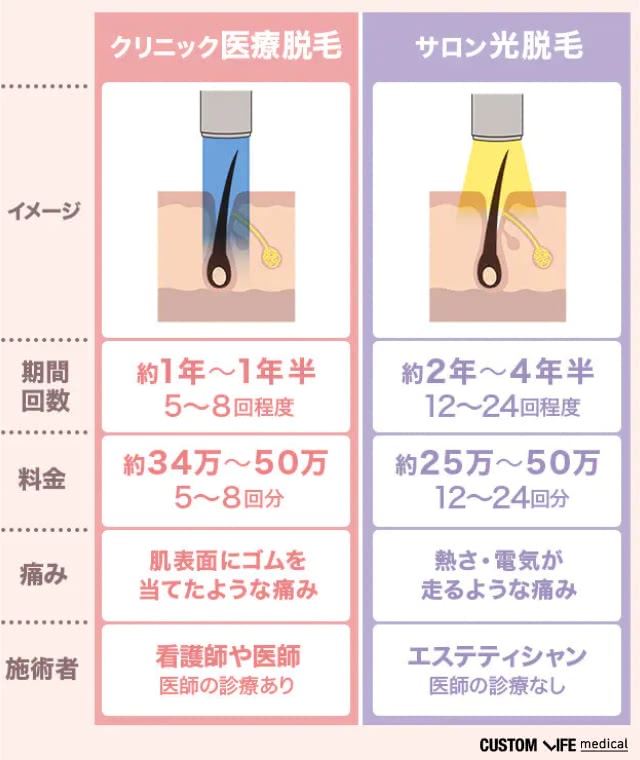 クリニック脱毛とサロン脱毛の違い一覧