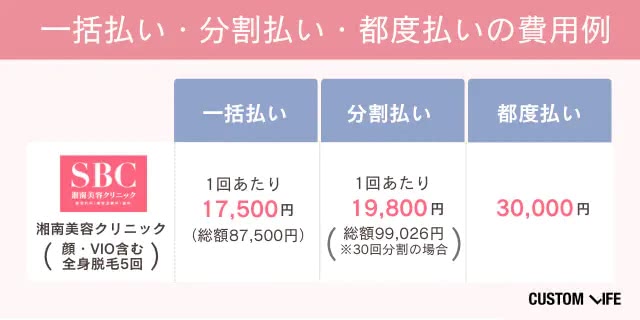 一括払い・分割払い・都度払いの費用例