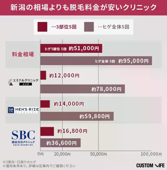 新潟でメンズのヒゲ脱毛をする場合に相場と比較