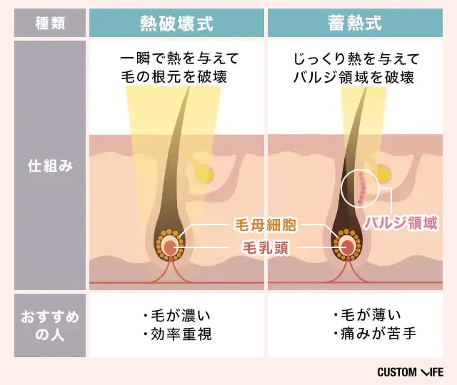 熱破壊式脱毛と蓄熱式脱毛の違いをまとめた画像