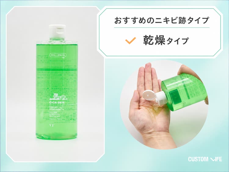 ニキビ跡,化粧水,tvt cicaスキン