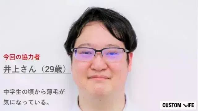 薄毛が気になる協力者井上さん