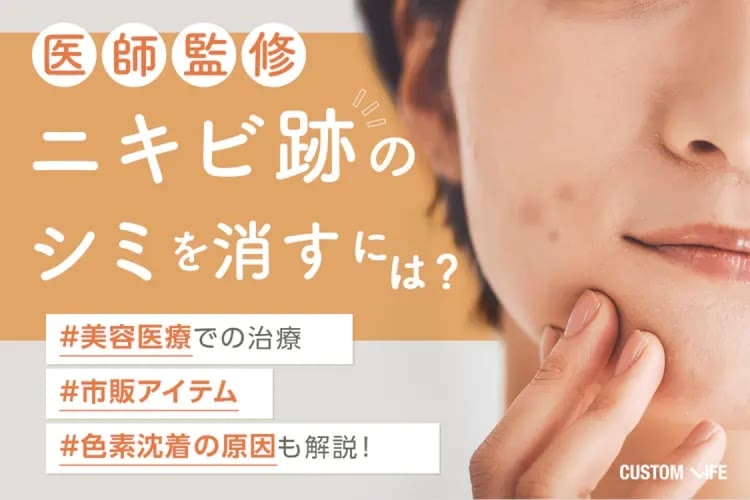 ニキビ跡のシミを消すには？皮膚科での治療・市販アイテムでのケア・色素沈着の原因も解説