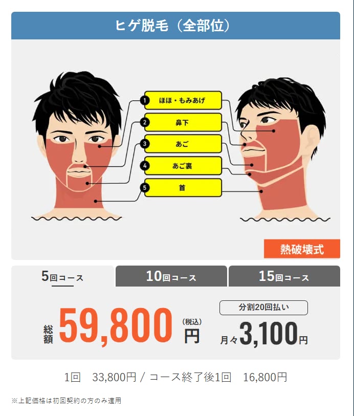 メンズリゼ顔全体プラン
