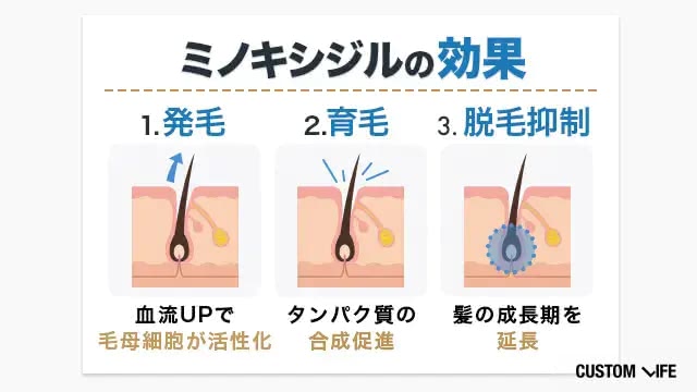 ミノキシジルの効果を完全解説