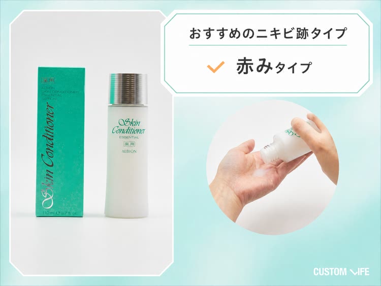 ニキビ跡,化粧水 アルビオン