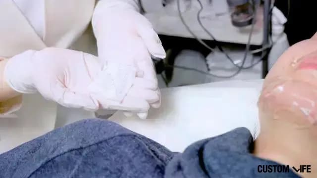 メンズTBCでヒゲ脱毛している編集部員と抜けたヒゲ