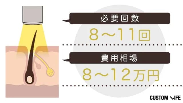 胸毛を光脱毛する場合の費用