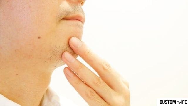 ヒゲ脱毛おすすめ
