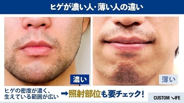 ヒゲの濃さの違い