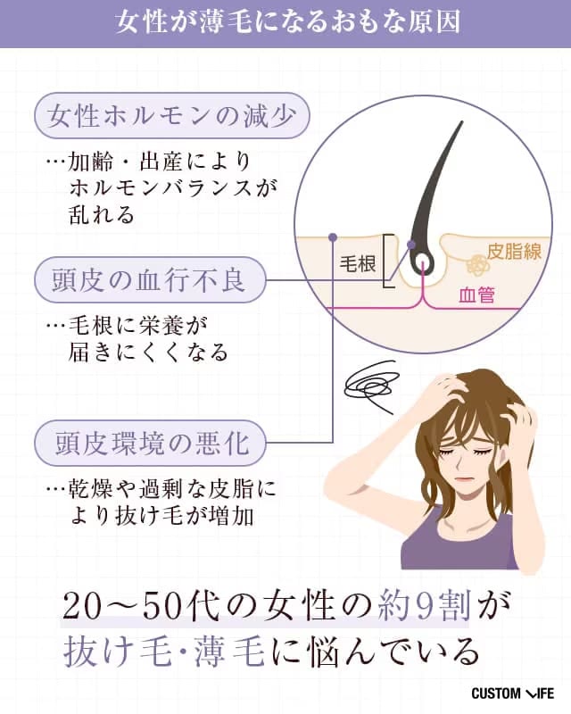 女性の薄毛の原因,女性ホルモンの減少,頭皮の血行不良,頭皮環境の悪化