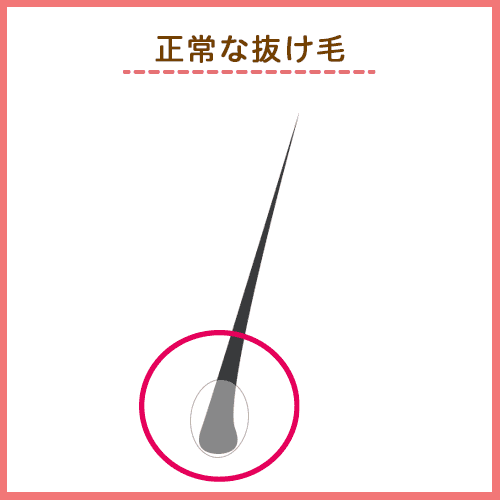 正常な抜け毛