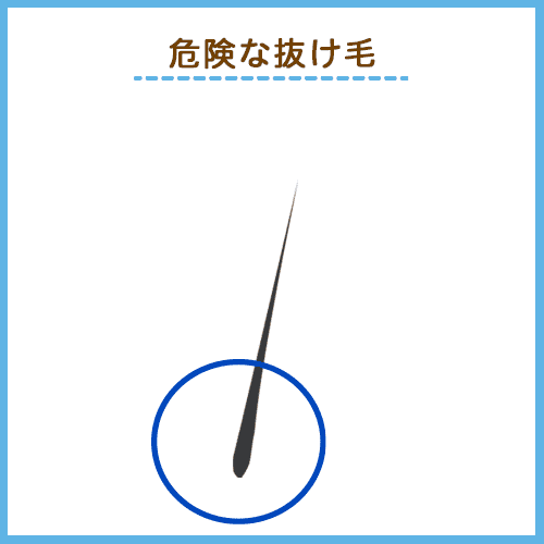 危険な抜け毛