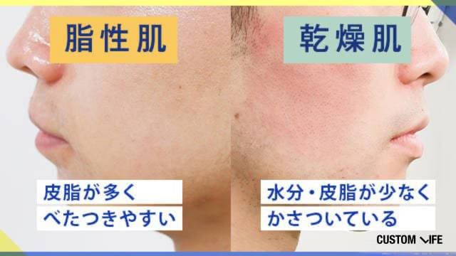 テカリ肌、乾燥肌の男性