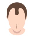 AGA男性の毛髪イラスト