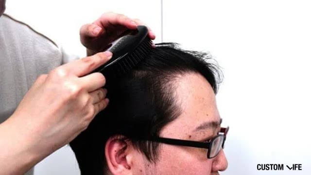 AGA診断を受けるカスタムライフmedicalメンズ編集部員