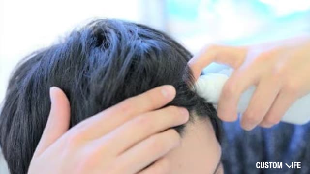 育毛剤を塗布する