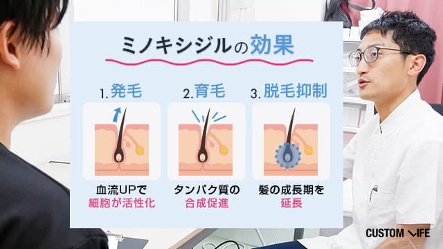 ミノキシジルの効果は1発毛2育毛3脱毛抑制