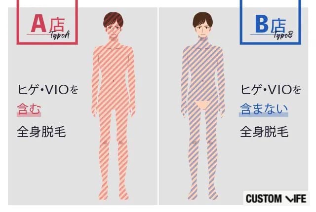 全身脱毛プランの施術部位の違いを表したイラスト