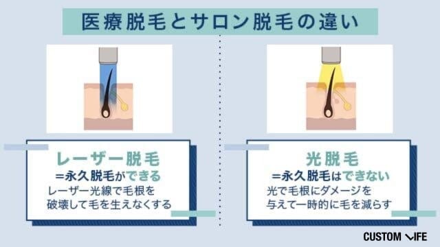 医療脱毛とサロン脱毛の違いを比較している画像