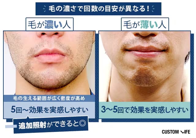 毛が濃い人・薄い人の特徴